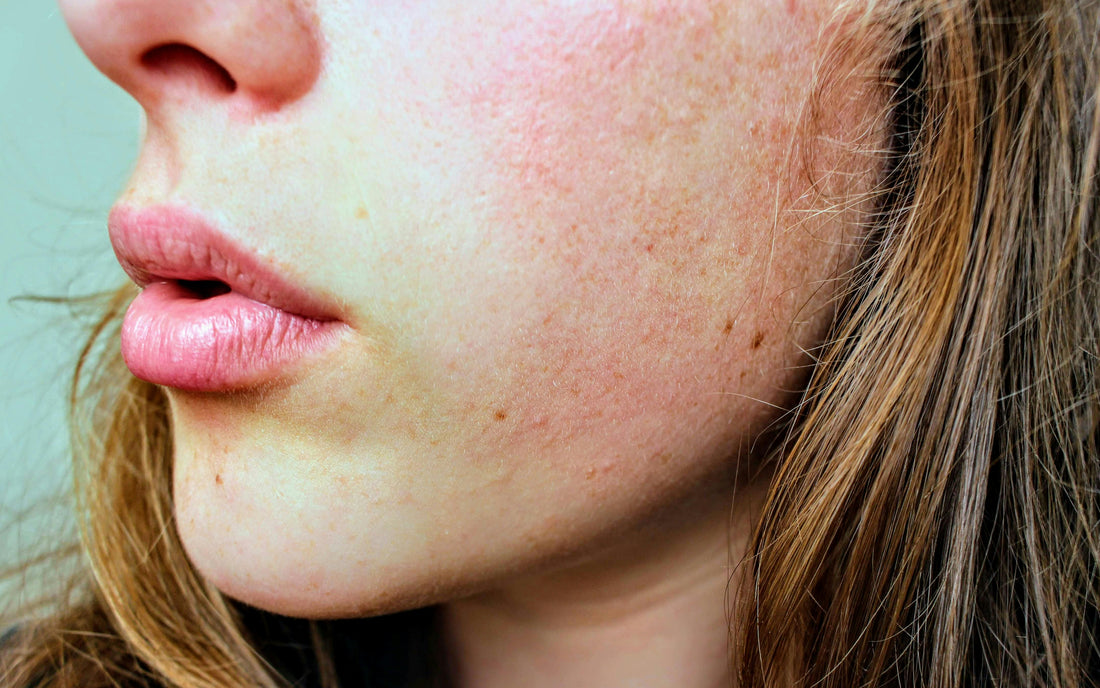 Can You Be Allergic to Magnesium?